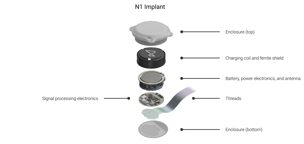 N1 implant