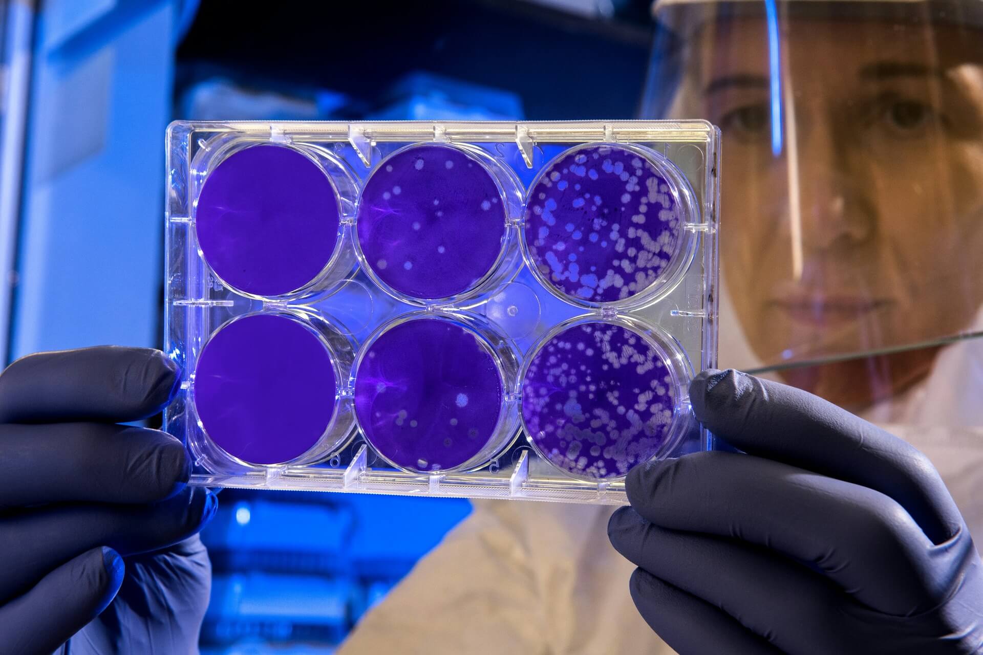 Does Stem Cell Therapy Work for Sports Injuries? - Modded